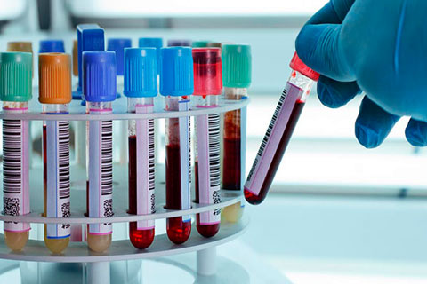 Spécialisation en Laboratoire Clinique